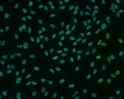 Otx2 Antibody (1H12C4B5), Novus Biologicals 0.025 mL, Unlabeled:Antibodies,